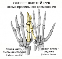 На цветном изображении (скелет кистей) показано расположение суставов основания пальцев у "дающей" руки (слева) и у "берущей" (справа)